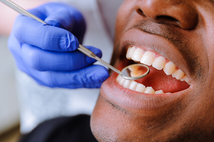Temporary Dental Staffing Services dentist for practices wearing glove holding small mirror in patient's mouth